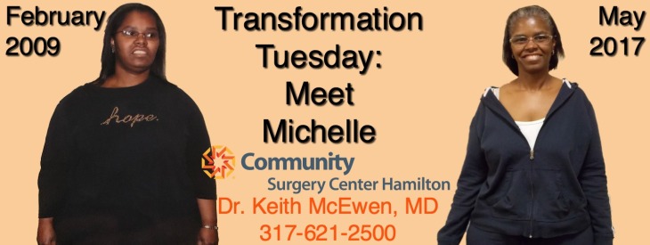 Dr. Keith McEwen MD Indianapolis Indiana Carmel Nobelsville Anderson Hamilton Community Surgery Center Hamilton Community Bariatrics Hamilton 46060 46011 46062 46033 46037 46074 46032 46220 46226 46055 46064 46030 46203 46239 46259 46163 46142 46143 lap-band system lap band system cost lap band system reviews lap band system patient education seminars lap band system access port lap band system pedometer lap band public system lap band ap system mri safety bioenterics lap band system lap-band ap system small lap band system lap-band system allergan lap band ap system large lap band gastric banding system franciscan health system lap band the new lap band system lap band through public system lap band surgery public system lap band system surgery the lap band system lap-band vg system what is lap band systemlap-band procedure lap-band removal lap-band system lap-band cost lap-band weight loss surgery lap-band complications lap-band diet lap-band® lap-band reviews lap-band alternative lap-band lap-band surgery lap-band adjustable gastric banding system lap band and pregnancy lap band australia lap band after gastric bypass lap band az lap band adjustment lap band and alcohol lap band and acid reflux lap band austin a lap band surgery a lap band removing a lap band can lapband be removed is a lap band permanent is a lap band safe is a lap band covered by insurance is a lap band reversible how a lap band works does a lap band work lap band before and after lap band before and after pictures lap band blog lap band before and after pics lap band brisbane lap band bmi lap band birmingham al lap band blockage lap band before and after stories lap band bariatric surgery b-2240 lap band lap band cost without insurance lap band covered by insurance lap band criteria lap band complications years later lap band canada lap band chicago lap band calgary lap band cons realize c lap band clap clap band clap clap bandcamp c section with lap band c-section and lap band surgery c section after lap band hepatitis c and lap band surgery lap band diet menu lap band diet plan lap band dallas lap band diet recipes lap band doctors lap band diet after surgery lap band dance lap band deaths lap band diet without surgery vitamin d deficiency lap band lap band erosion lap band edmonton lap band eligibility lap band erosion causes lap band eating plan lap band erosion lawsuit lap band experiences lap band eating rules lap band esophagus problems lap band erosion complications o que e lap band lap band forum lap band fill lap band failure lap band friendly recipes lap band forum australia lap band failure rate lap band food stuck lap band fill centers lap band failure stories lap band fort worth lap band gal lap band gone wrong lap band gas pain lap band gaining weight back lap band guidelines lap band gurgling noises lap band green zone lap band gallbladder issues lap band good or bad lap band gerd issues lap band houston lap band hypnosis lap band horror stories lap band heartburn and reflux lap band heartburn lap band hypnotherapy lap band houston cost lap band hobart lap band hair loss lap band hernia h pylori lap band lap band insurance lap band issues lap band in mexico lap band information lap band images lap band indiana lap band insurance requirements lap band infection lap band in houston lap band in mexico cost i lap band i want lap band surgery lap band jacksonville fl lap band journey lap band journey blog lap band jackson ms lap band joplin mo lap band joondalup lap band journal lap band jonesboro arkansas lap band jokes lap band juicing j&j lap band lap band kansas city lap band kaiser lap band knoxville tn lap band kelowna lap band killeen texas lap band katy tx lap band kidney stones lap band korea lap band kingsport tn lap band katy lap band lawsuit lap band las vegas lap band liquid diet lap band louisville ky lap band little rock ar lap band leak symptoms lap band lubbock lap band liquid diet recipes lap band long term complications lap band los angeles lap band mexico lap band meal plan lap band miami lap band mri safety lap band melbourne lap band meals lap band macon ga lap band medicare lap band memphis lap band mexico cost u of m lap band surgery lap band not working lap band not losing weight lap band night cough lap band nj lap band nz lap band nyc lap band no surgery lap band no weight loss lap band nausea lap band nutrition guidelines lite n easy lap band lap band or sleeve lap band okc lap band of louisville lap band ontario lap band orlando lap band operation lap band oklahoma lap band ontario cost lap band omaha lap band or sleeve which is better o sign lap band o'brien lap band placer cost of lap band surgery symptoms of lap band erosion removal of lap band dangers of lap band surgery symptoms of lap band slippage complications of lap band surgery complications of lap band cost of lap band removal lap band problems lap band pictures lap band pros and cons lap band pre op diet lap band port lap band price lap band port pain lap band post op diet lap band pregnancy s p lap band lap band qualifications lap band qualifications 2014 lap band qualifications 2015 lap band qualifications 2013 lap band questions lap band questions and answers lap band quiz lap band queensland lap band quick weight loss lap band qld q&a lap band lap band requirements lap band recipes lap band recovery lap band risks lap band results lap band removal recovery lap band removal surgery lap band removal complications lap-band surgery pros and cons lap band surgery cost lap band side effects lap band slippage lap band surgery reviews lap band surgery requirements lap band success stories lap band surgery risks s code for lap band adjustment what is lap band lap band talk lap band toronto lap band to sleeve revision lap band to gastric sleeve lap band testimonials lap band to gastric sleeve revision lap band tulsa lap band tucson lap band to gastric sleeve conversion lap band to sleeve conversion lap band t shirt lap band utah lap band uk lap band utah cost lap band unfill lap band united healthcare lap band ulcer lap band unfilled problems lap band ulcer issues lap band unsuccessful stories lap band upper gi youtube lap band youtube lap band surgery lap band u of m lap band vs sleeve lap band vomiting lap band video lap band vs bypass lap band vomiting after eating lap band vs sleeve 2013 lap band vomiting slime lap band vancouver lap band vs slimband lap band vomiting in sleep gastric bypass v lap band lap band v sleeve lap band weight loss lap band with plication lap band wiki lap band weight loss expectations lap band without surgery lap band weight loss results lap band weight requirements lap band weight loss first month lap band weight loss rate lap band w/plication lap band x ray gastric band x ray lap band slippage x ray slipped lap band x ray lap band position x ray gastric lap band x ray lap band angle x ray lap band surgery x ray x ray of lap band x ray of slipped lap band gas x after lap band lap band youtube lap band youtube video lap band youtube before and after lap band yahoo answers lap band yes or no lap band young adults lap band yuma az lap band years later lap band york pa lap band youtube 2012 lap band zones lap band zephyrhills florida gastric band zones lap band red zone lap band surgery zanesville ohio lap band new zealand lap band cost new zealand zoloft lap band lap band surgery christchurch new zealand gastric band zürich lap band 10 years later lap band 1st fill lap band 1 year later lap band 1 week post op lap band 101 lap band 1 month post-op lap band 18 years old lap band 16 year old lap band 14cc lap band 15 year old 1 800 lap band week 1 lap band diet lap band 2014 lap band 2013 lap band 2 week liquid diet lap band 2015 lap band 20 years old lap band 2 years post-op lap band 2 weeks post op lap band 2 months post op lap band 22 years old lap band 200 lbs week 2 lap band diet 2 year old lap band 2 dangers of lap band surgery 2 years after lap band 2 months after lap band 2 weeks after lap band lap band 2 years later day 2 after lap band lap band 30 pounds overweight lap band 3 weeks post op lap band 3 months post op lap band 3 years post op lap band 3 days post op lap band 35 bmi lap band 3 months later lap band 3 years later lap band 33 bmi lap band 31 bmi stage 3 lap band diet 3 lap joint band clamp week 3 lap band diet phase 3 lap band diet 3 months after lap band 3 days post lap band week 3 post lap band lap band 4 years later lap band 40 pounds overweight lap band 400 lbs lap band 4cc lap band after 4 years lap band for 40 lbs. overweight lap band week 4 allergan lap band 4cc lap band stage 4 diet lap band to lose 40 pounds stage 4 lap band diet 4 years after lap band 4 weeks after lap band lap band 5 years later lap band 5 day pouch test lap band 5 years post op lap band 50 lbs overweight lap band 5 cc fill lap band 5 months post op lap band 5 weeks post-op lap band $5000 lap band 50 pounds overweight lap band 5 day diet stage 5 lap band diet 5 years after lap band 5 days post op lap-band lap band 6 months post op lap band 60 pounds overweight lap band 6 years later lap band 6 cc fill lap band 6 weeks post op lap band 6 month diet lap band after 6 years lap band after 6 months lap band surgery over 60 lap band surgery over 65 6 months after lap band lap band 70 pounds overweight lap band after 7 years lap band surgery 77062 lap band 8 golden rules lap band after 8 years 800 lap band 8 golden rules lap band 8 rules of lap band lap band icd 9 lap band icd-9 code lap band erosion icd 9 lap band removal icd 9 lap band complication icd 9 lap band failure icd 9 slipped lap band icd-9 code 9.75 lap band infected lap band icd 9 icd 9 lap band complications icd 9 lap band icd 9 lap band surgery icd 9 lap band adjustment icd 9 gastric lap band icd 9 failed lap band icd 9 for lap band erosion bariatric banding surgery bariatric band surgery cost bariatric band diet bariatric band slippage bariatric band fills bariatric band complications bariatric band adjustment bariatric band manufacturers bariatric lap band bariatric lap band surgery problems bariatric band bariatric band surgery lap band bariatric surgery stomach band after pregnancy stomach band after c section stomach band as seen on tv stomach band after hysterectomy stomach band and cream to lose weight stomach band alternative stomach band at walmart stomach band and pregnancy stomach band after cesarean bariatric belly band stomach burner band stomach band before and after stomach band belt baby stomach band best stomach band after pregnancy best stomach band ballet stomach band lap band bariatric surgery before after bariatric surgery bypass vs band stomach band cost laparoscopic band complications stomach band covered by insurance stomach band cost canada stomach band canada stomach band cost sydney stomach band cost uk laparoscopic band cost stomach band candidate stomach band during pregnancy stomach band diabetes bariatric lap band diet bariatric surgery lap band diet stomach band exercise stomach band erosion stomach elastic band stomach earth band stomach elastic band surgery' stomach band to lose weight stomach band for working out stomach band for after pregnancy stomach band for pregnancy stomach band for exercise stomach band for acid reflux stomach band for running stomach band for abs stomach band for working out walmart stomach band hypnosis stomach band holster stomach band hypnotherapy stomach heat band stomach band infomercial stomach band in pakistan i-band bariatric surgery stomach band japanese stomach band japan stomach band lose weight stomach lift band lap band bariatric surgery cost lap band bariatric surgery forums lap band vs bariatric surgery bariatric lap band surgery diet bariatric lap band recipes stomach band mexico stomach band modells stomach muscle band stomach monkeys band stomach mouth band stomach band nz stomach band operation stomach band on nhs lap band or bariatric surgery stomach omaha band stomach band procedure stomach band post pregnancy stomach band pregnancy stomach band price stomach band problems laparoscopic band phi angle laparoscopic band placement laparoscopic band port stomach band perth laparoscopic band passer laparoscopic band removal stomach band reviews laparoscopic band radiographics stomach band removal laparoscopic band removal cpt code stomach band requirements stomach band risks stomach band recovery time laparoscopic band radiology laparoscopic band removal cpt bariatric surgery band slip stomach band surgery cost laparoscopic band surgery stomach band surgery risks stomach band surgery cost canada stomach band side effects laparoscopic band surgery cost stomach band to lose belly fat stomach band to lose weight cost stomach band that burns fat stomach band that makes you sweat stomach band to sweat stomach band to lose weight as seen on tv stomach band to workout stomach band toronto stomach band target stomach band uk stomach vibrating band lap band vs sleeve bariatric surgery bariatric sleeve vs band bariatric advantage vitaband stomach band walmart stomach band workout stomach band while working out stomach band wrap stomach band with gel stomach band while exercising stomach band wiki stomach band working out stomach band with lotion stomach band youtube lapbandindiana.com